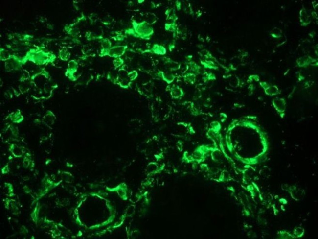 Vimentin Antibody in Immunohistochemistry (Frozen) (IHC (F))