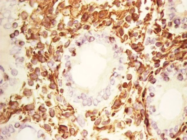 Vimentin Antibody in Immunohistochemistry (Frozen) (IHC (F))