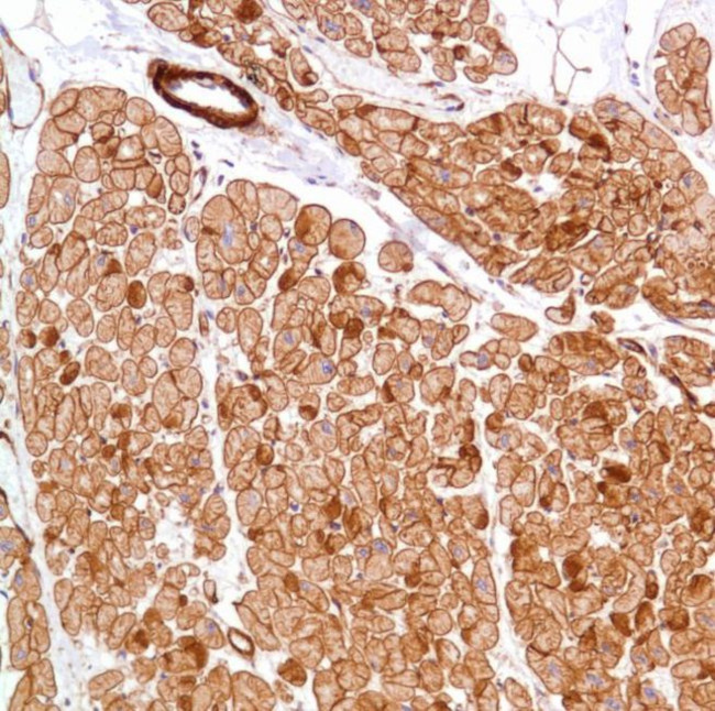 Vinculin Antibody in Immunohistochemistry (Paraffin) (IHC (P))