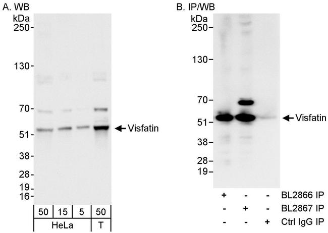 NAMPT/PBEF/Visfatin Antibody in Western Blot (WB)