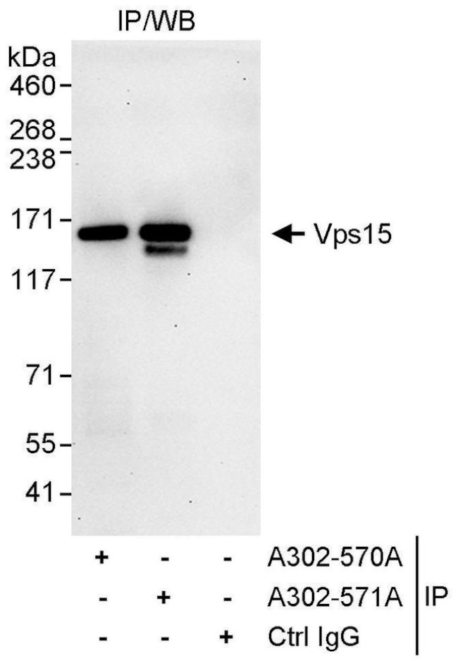 Vps15 Antibody in Immunoprecipitation (IP)