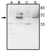 CHX10 Antibody in Western Blot (WB)