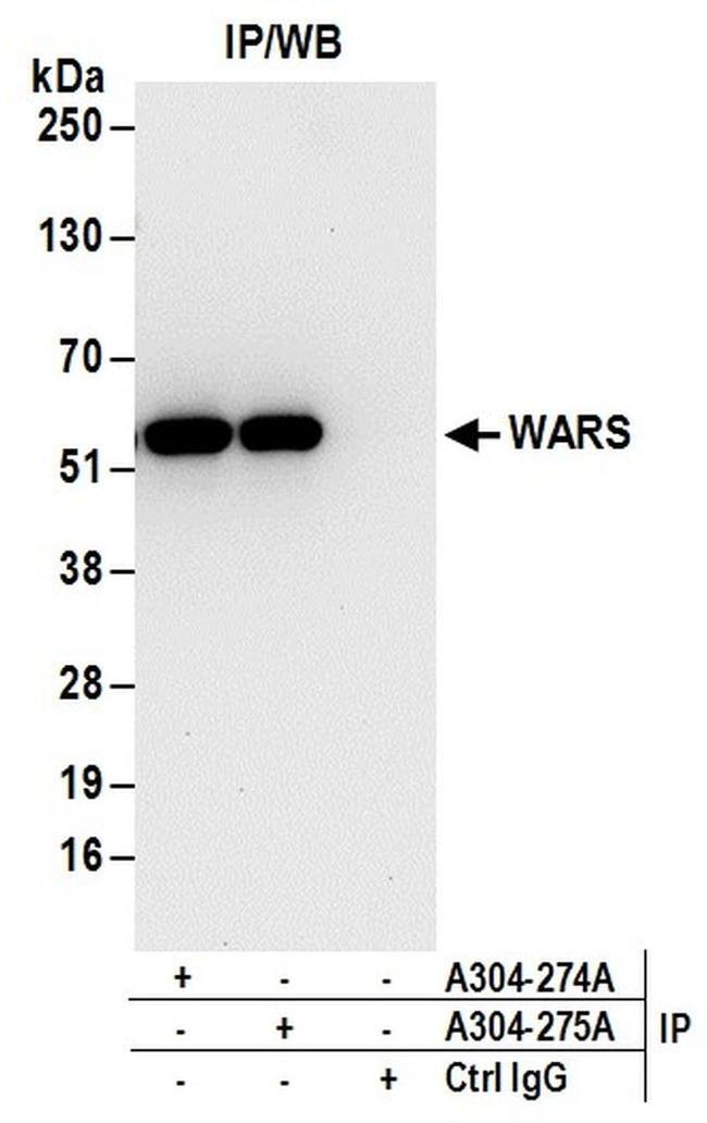 WARS Antibody in Western Blot (WB)