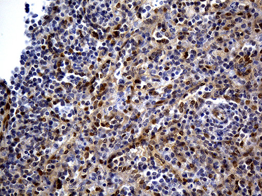 WASL Antibody in Immunohistochemistry (Paraffin) (IHC (P))