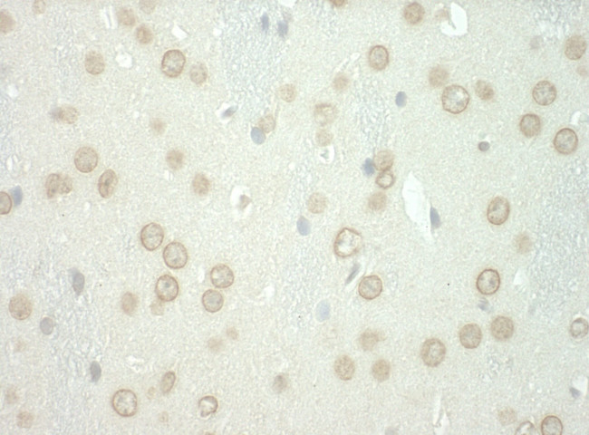 WDFY3 Antibody in Immunohistochemistry (IHC)