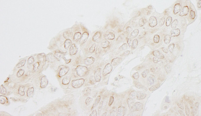 WDFY3 Antibody in Immunohistochemistry (IHC)