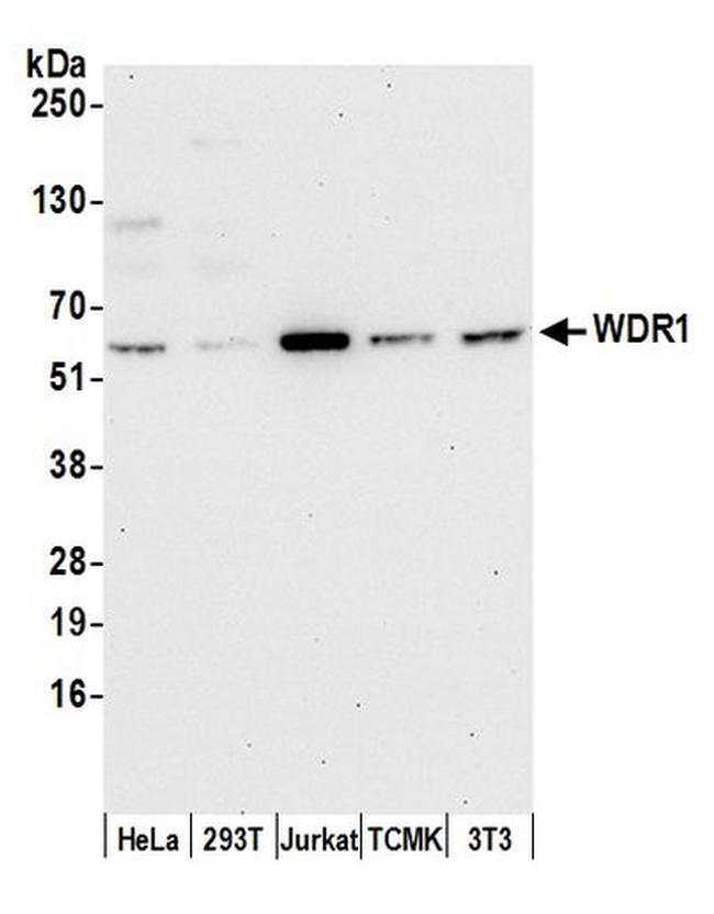 WDR1 Antibody in Western Blot (WB)