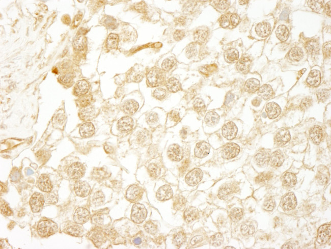 WDR20 Antibody in Immunohistochemistry (IHC)