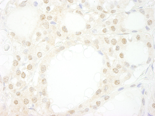 WDR20 Antibody in Immunohistochemistry (IHC)