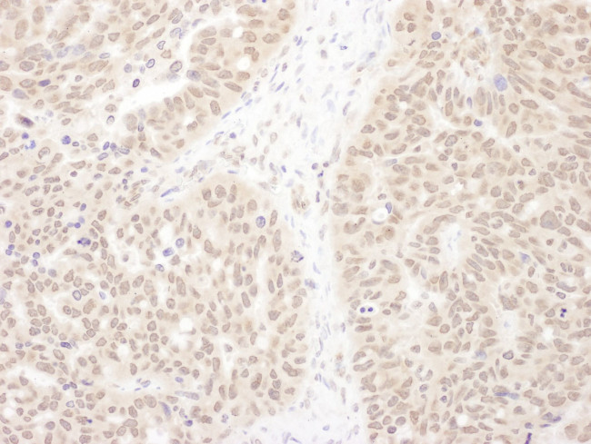 WDR5 Antibody in Immunohistochemistry (IHC)