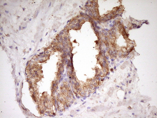 WDR61 Antibody in Immunohistochemistry (Paraffin) (IHC (P))