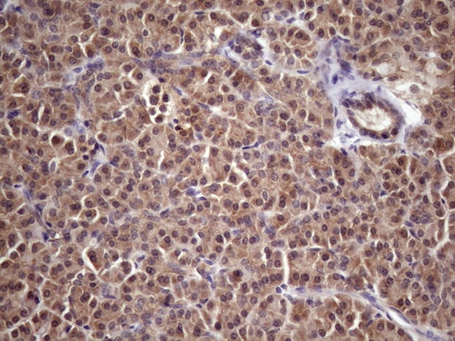 WDR61 Antibody in Immunohistochemistry (Paraffin) (IHC (P))