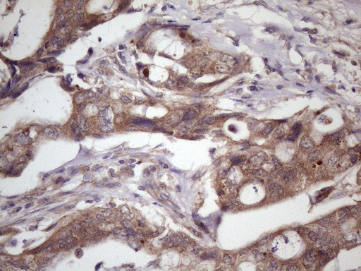 WDR61 Antibody in Immunohistochemistry (Paraffin) (IHC (P))