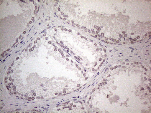 WDR61 Antibody in Immunohistochemistry (Paraffin) (IHC (P))