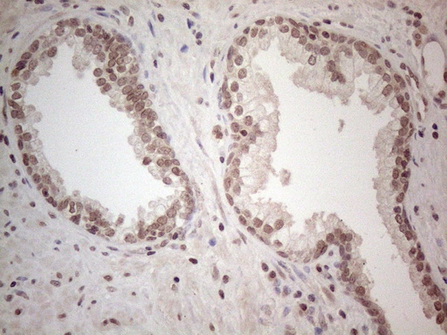 WDR61 Antibody in Immunohistochemistry (Paraffin) (IHC (P))