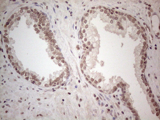 WDR61 Antibody in Immunohistochemistry (Paraffin) (IHC (P))