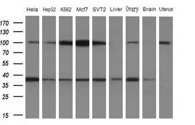 WDR61 Antibody in Western Blot (WB)