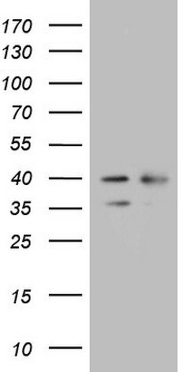 WDR61 Antibody in Western Blot (WB)