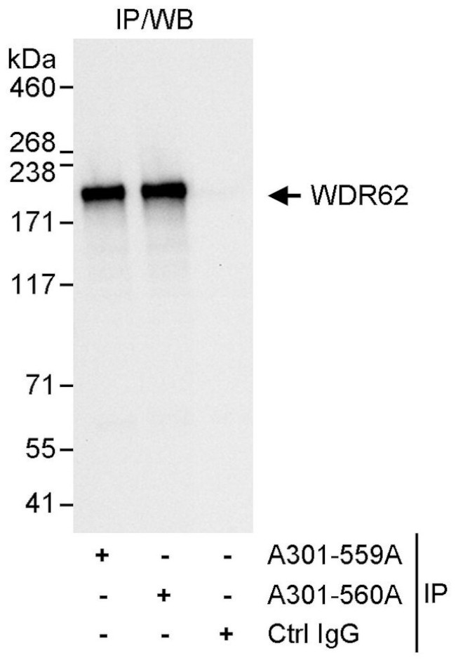 WDR62 Antibody in Immunoprecipitation (IP)