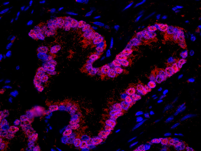 WDR77/MEP50 Antibody in Immunohistochemistry (IHC)