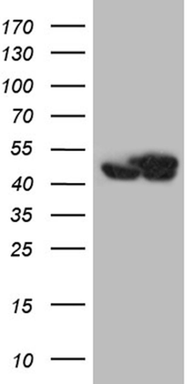 WDR77 Antibody in Western Blot (WB)