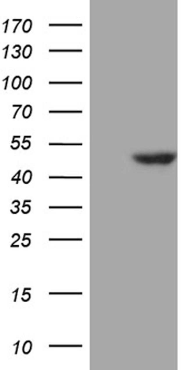 WDR77 Antibody in Western Blot (WB)