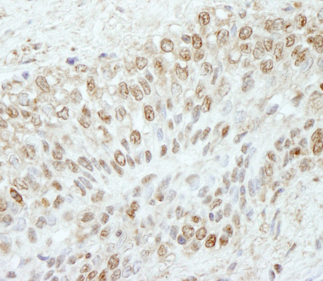 WDR91 Antibody in Immunohistochemistry (IHC)