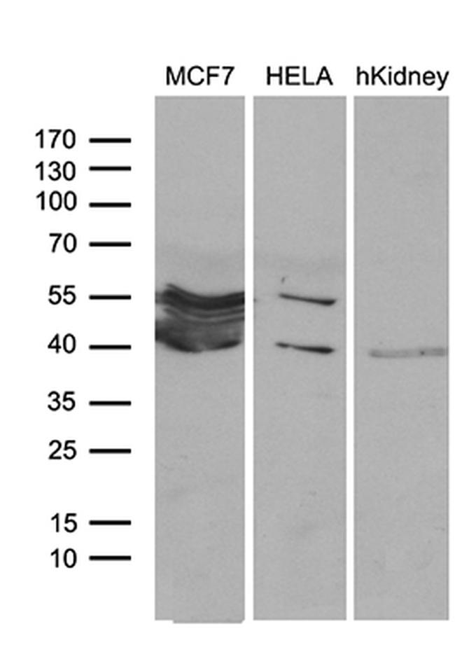 WDR92 Antibody in Western Blot (WB)