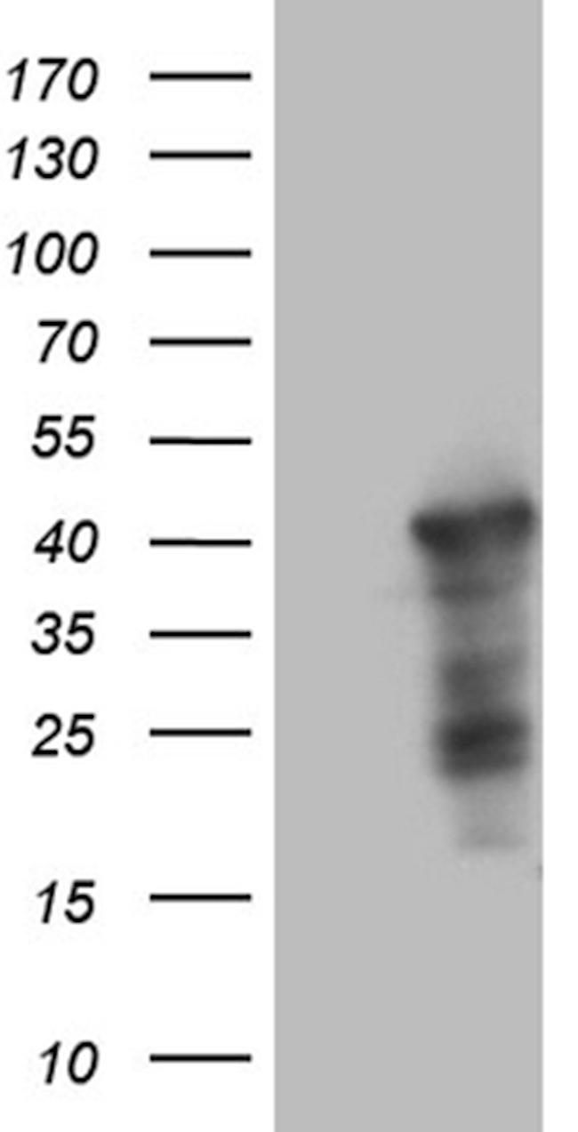 WDR92 Antibody in Western Blot (WB)