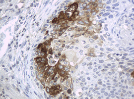 WFDC2 Antibody in Immunohistochemistry (Paraffin) (IHC (P))