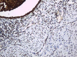 WFDC2 Antibody in Immunohistochemistry (Paraffin) (IHC (P))