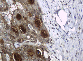 WFDC2 Antibody in Immunohistochemistry (Paraffin) (IHC (P))