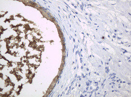 WFDC2 Antibody in Immunohistochemistry (Paraffin) (IHC (P))