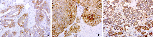 WFDC2 Antibody in Immunohistochemistry (Paraffin) (IHC (P))