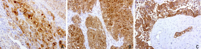 WFDC2 Antibody in Immunohistochemistry (Paraffin) (IHC (P))