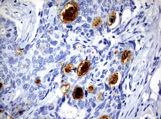 WFDC2 Antibody in Immunohistochemistry (Paraffin) (IHC (P))