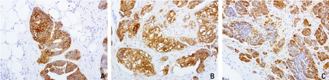 WFDC2 Antibody in Immunohistochemistry (Paraffin) (IHC (P))