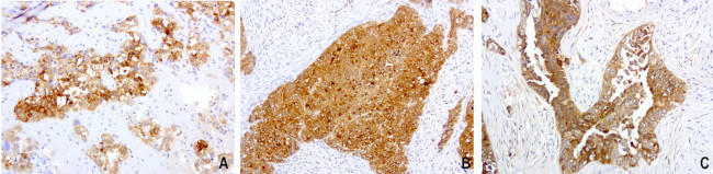 WFDC2 Antibody in Immunohistochemistry (Paraffin) (IHC (P))