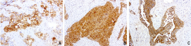 WFDC2 Antibody in Immunohistochemistry (Paraffin) (IHC (P))