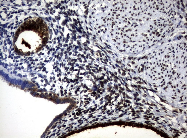 WFDC2 Antibody in Immunohistochemistry (Paraffin) (IHC (P))