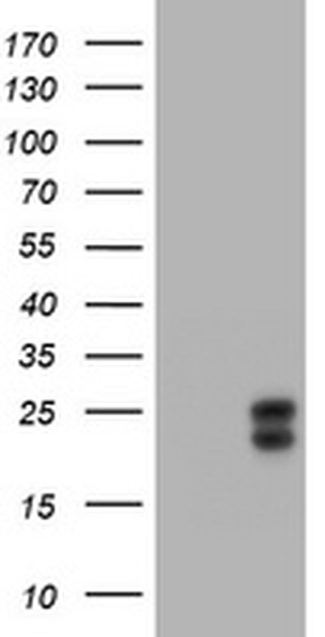 WFDC2 Antibody in Western Blot (WB)