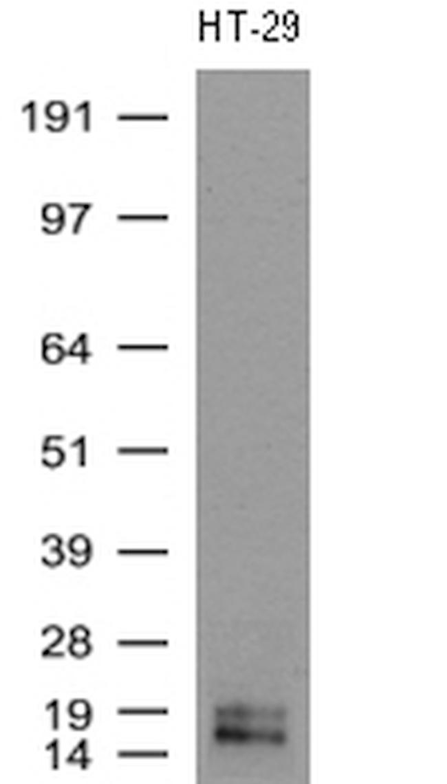 WFDC2 Antibody in Western Blot (WB)