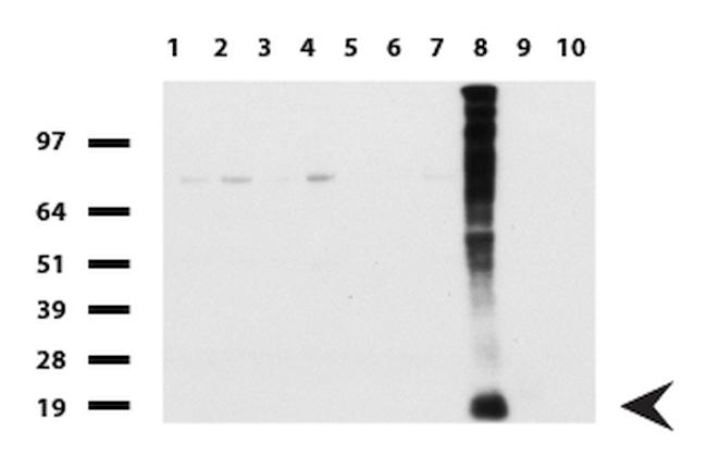 WFDC2 Antibody in Western Blot (WB)