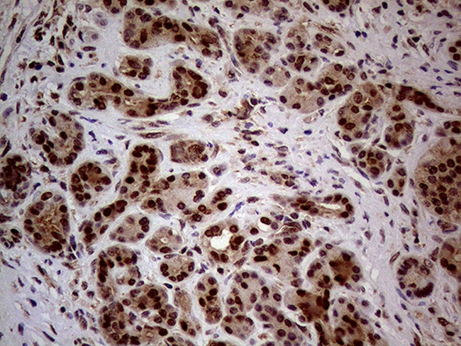 WHSC1L1 Antibody in Immunohistochemistry (Paraffin) (IHC (P))