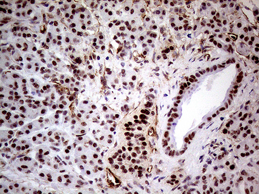 WHSC1L1 Antibody in Immunohistochemistry (Paraffin) (IHC (P))