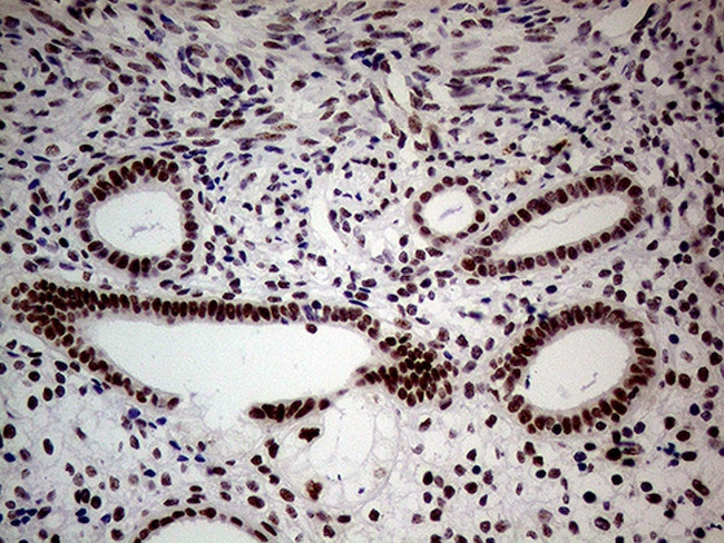 WHSC1L1 Antibody in Immunohistochemistry (Paraffin) (IHC (P))