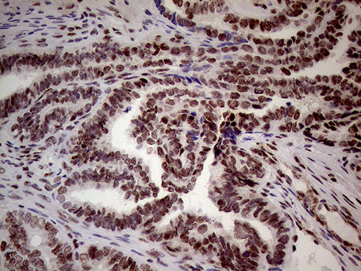 WHSC1L1 Antibody in Immunohistochemistry (Paraffin) (IHC (P))