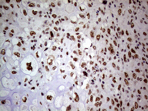 WHSC1L1 Antibody in Immunohistochemistry (Paraffin) (IHC (P))