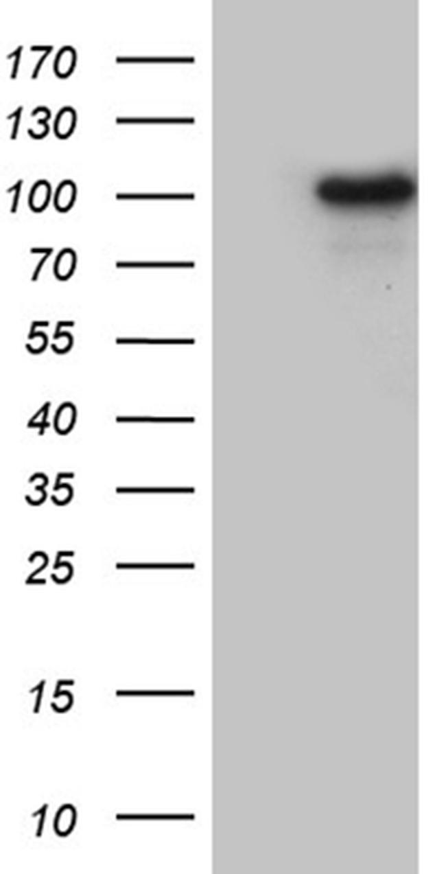 WHSC1L1 Antibody in Western Blot (WB)