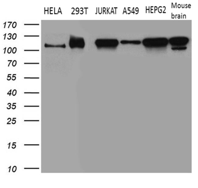 WHSC1L1 Antibody in Western Blot (WB)